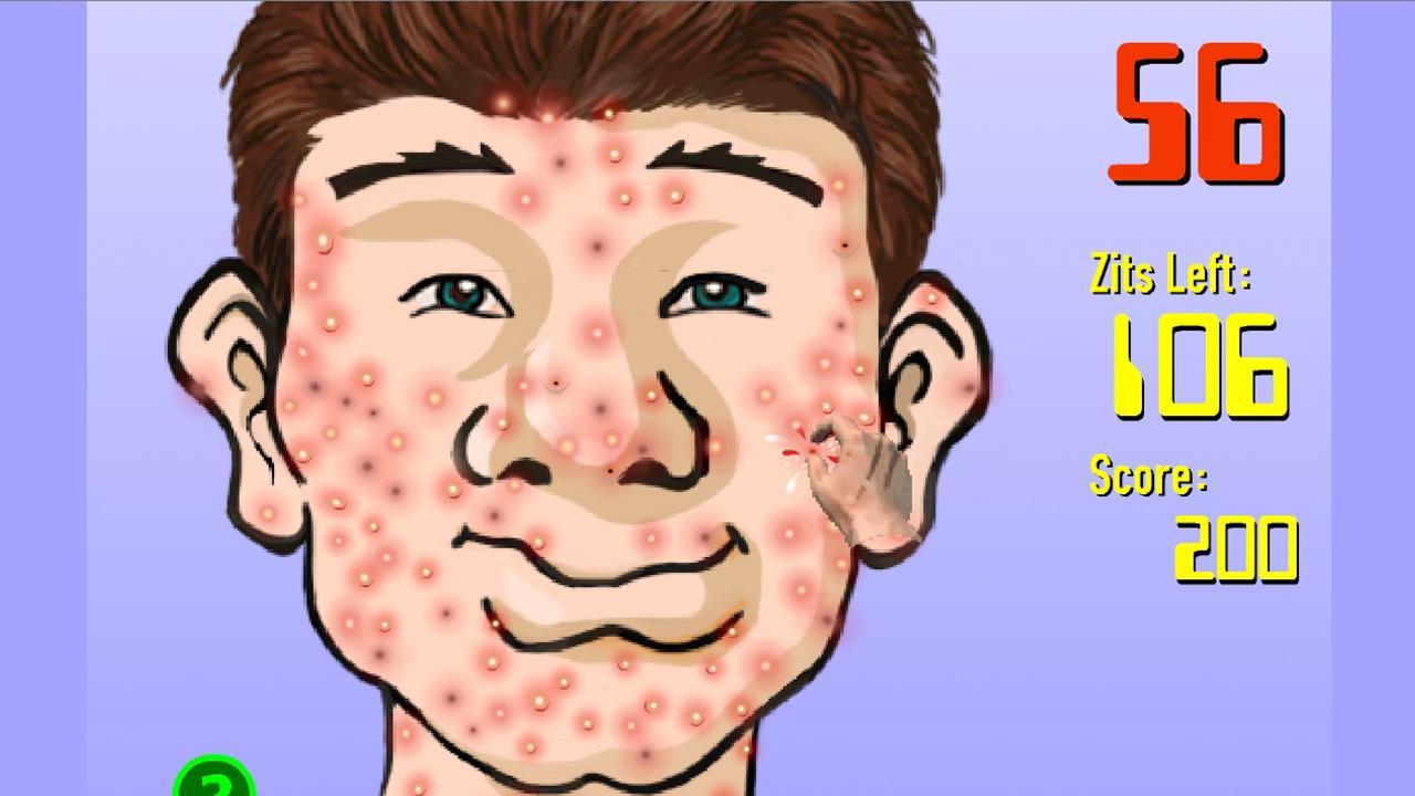 Squeeze Acne