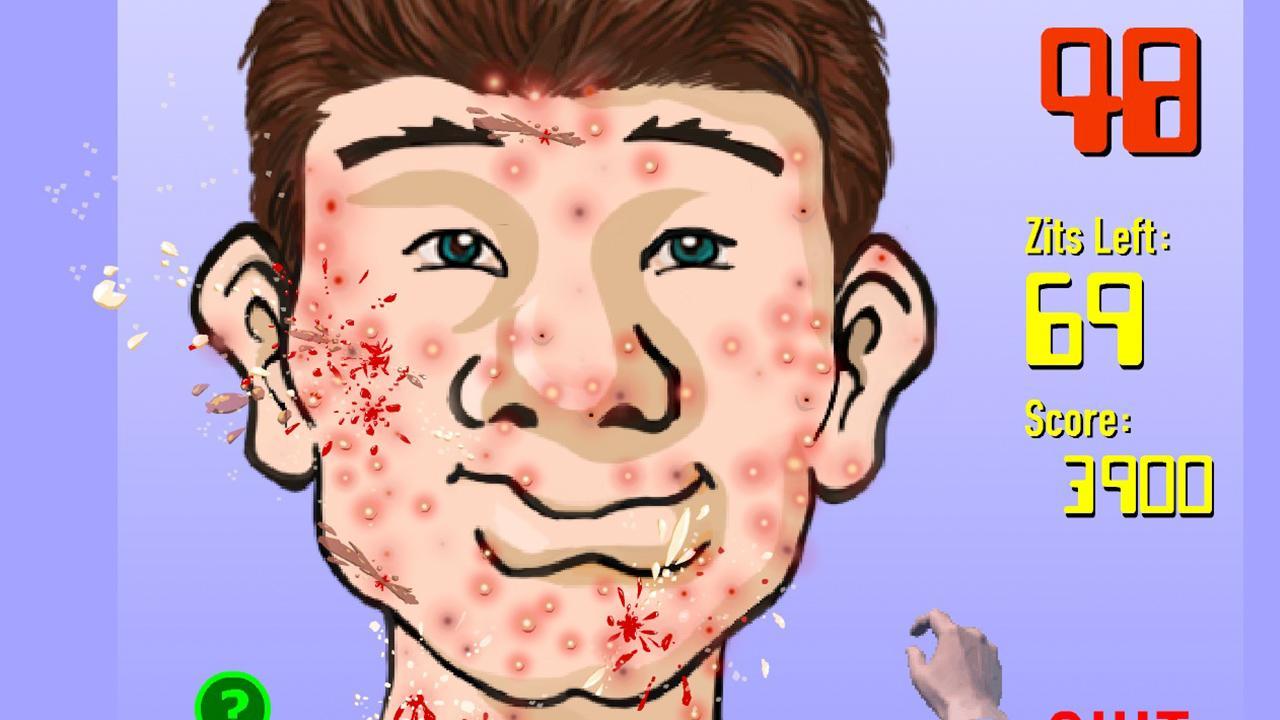 Squeeze Acne